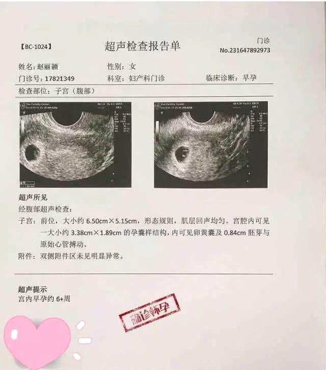 赵丽颖冯绍峰结婚后究竟有没有怀孕？网曝春节后生男孩？