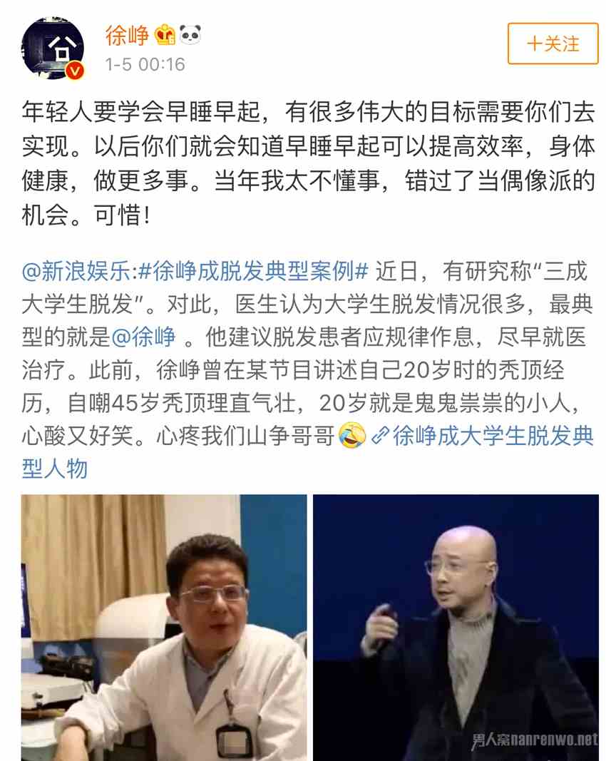 徐峥回应成脱发典型人物