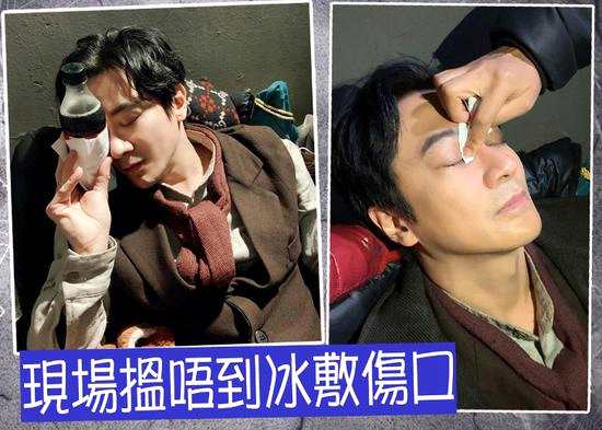孙耀威拍戏受伤，被网友指责摆拍博同情