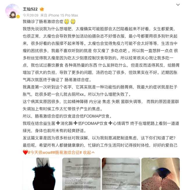 杜淳老婆王灿确诊肠易激综合症 体重不足80斤