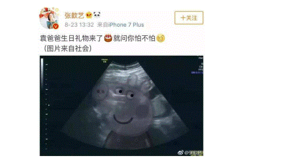 张歆艺宣布怀孕.GIF
