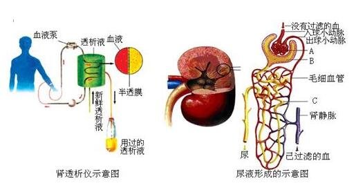 肾透析概念股.jpg