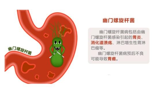 幽門螺旋桿菌.jpg