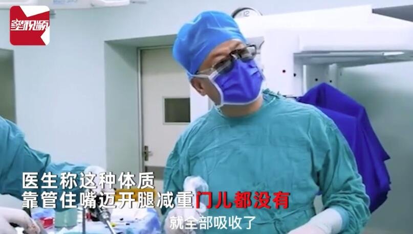 一女子被发现小肠长达12.5米 医生：管住嘴迈开腿也减不了肥